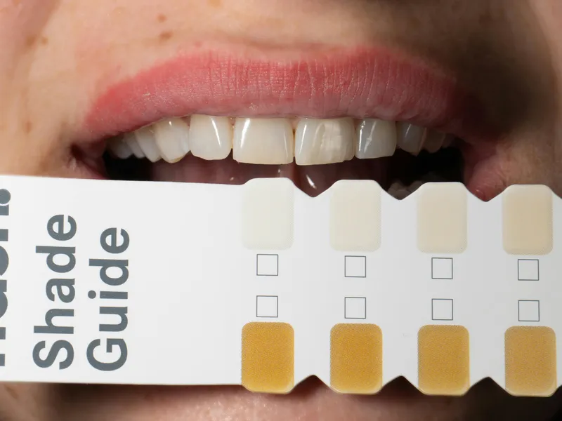 A Brighter Smile Starts Here background